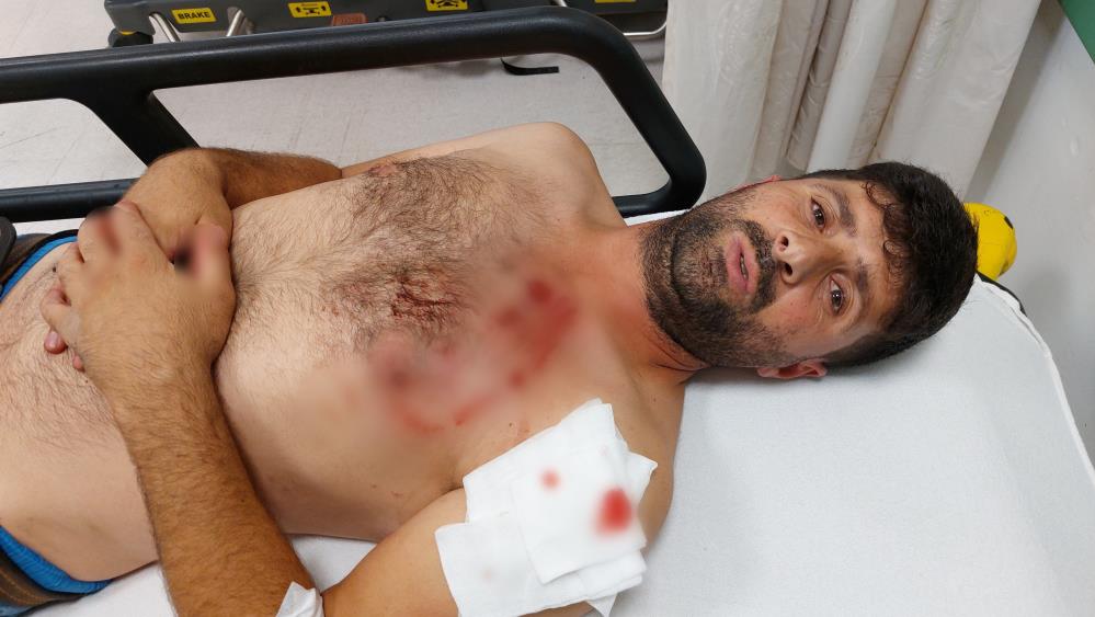 Samsun'da Köpeğin Saldırısına Uğrayan Şahıs Kanlar İçinde Kalarak Ölümden Döndü