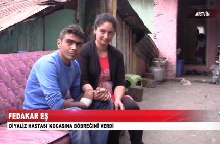 Eşine Böbreğini Verdi