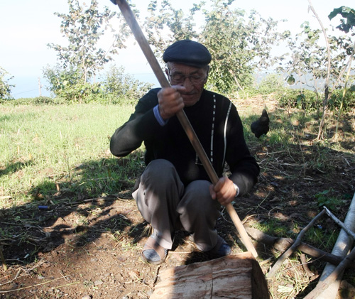 77'sinde Tek Böbreği Olduğunu Öğrendi