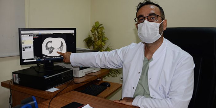 Koronavirüsle Öücadele Eden Doktor, 'Tanık Olduklarımı Gören Biri Evden Dışarı Çıkmazdı'