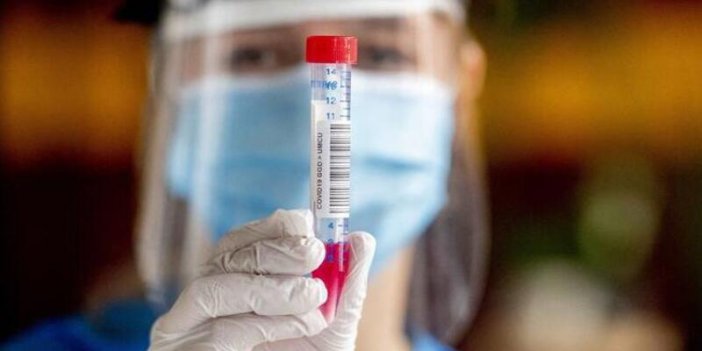 Kovid-19 Rize'de 4 Kişiyi Daha Aramızdan Ayırdı