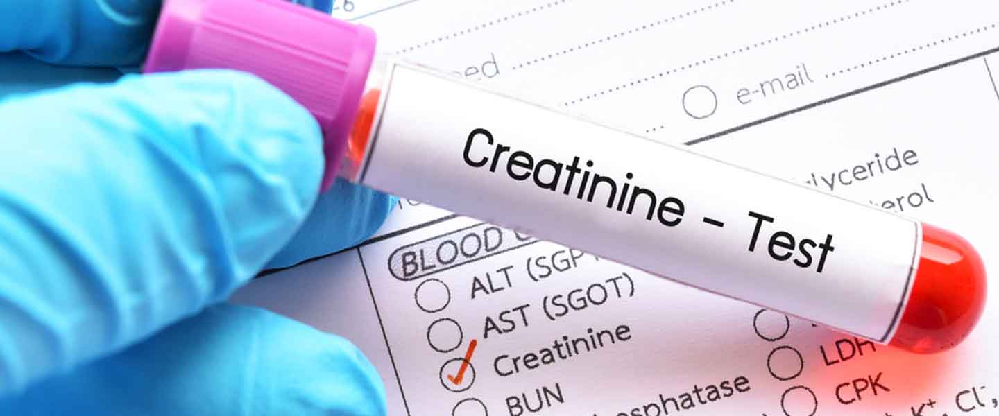 Kreatinin Nedir? Kreatinin Düşüklüğü ve Yükseliği Ne Anlama Gelir?