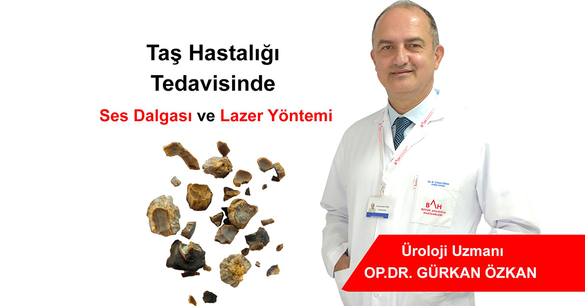 Taş Hastalığı Tedavisinde 'Ses Dalgası' ve 'Lazer' Yöntemi