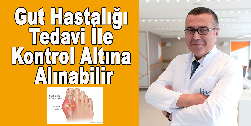 Prof. Dr. Sayarlıoğlu: Gut hastalığı tedavi ile kontrol altına alınabilir