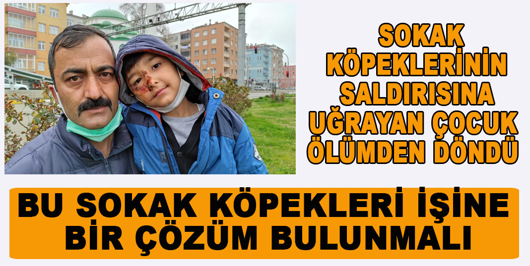 Sokak köpeklerinin saldırısına uğrayan çocuk ölümden kurtuldu