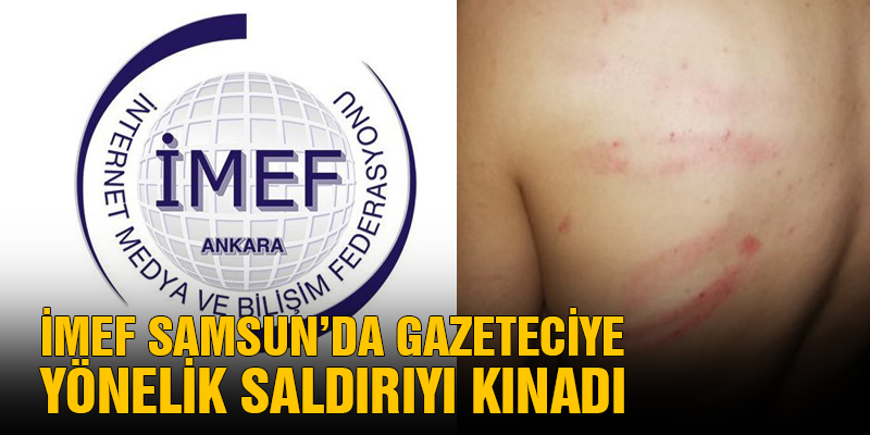 İnternet Medya Bilişim Federasyonu, Samsun'da Gazeteciye Yönelik Saldırıyı Kınadı