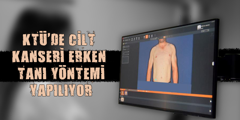 KTÜ'de Cilt Kanserinde Erken Tanı Yapılıyor