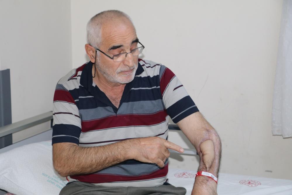 RİZE’DE GEÇİRDİĞİ TRAFİK KAZASI SONRASI TEDAVİ ALTINA ALINMASI İÇİN TRABZON’A SEVK EDİLEN AVNİ KURU, DOKTORLARIN GEÇ MÜDAHALESİ NEDENİYLE KOLUNUN ÇÜRÜDÜĞÜNÜ ANCAK İSTANBUL'DA YAPILAN DOKU NAKLİ İLE KOLU KURTARILDI
