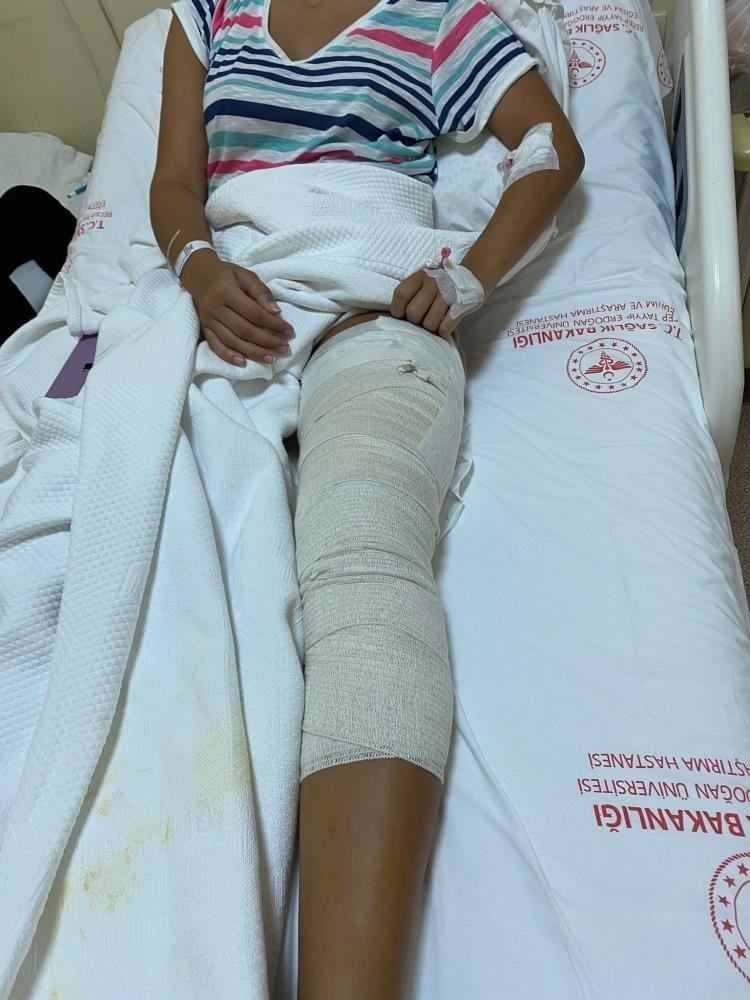 Rize'de Ayağına Yorgun Mermi İsabet Eden Genç Kız: "mermi 1 Santimetre Daha Gitseydi Sakat Kalabilirdim"