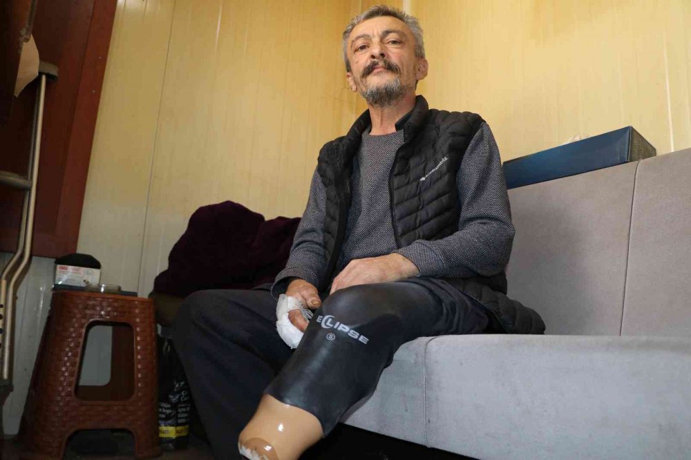 RİZE'DE HASTALIĞI YÜZÜNDEN AYAĞI KESİLEN 58 YAŞINDAKİ KÖKSAL SAĞIR, PROTEZ BACAKLA TEKRARDAN YÜRÜMEYE BAŞLADI