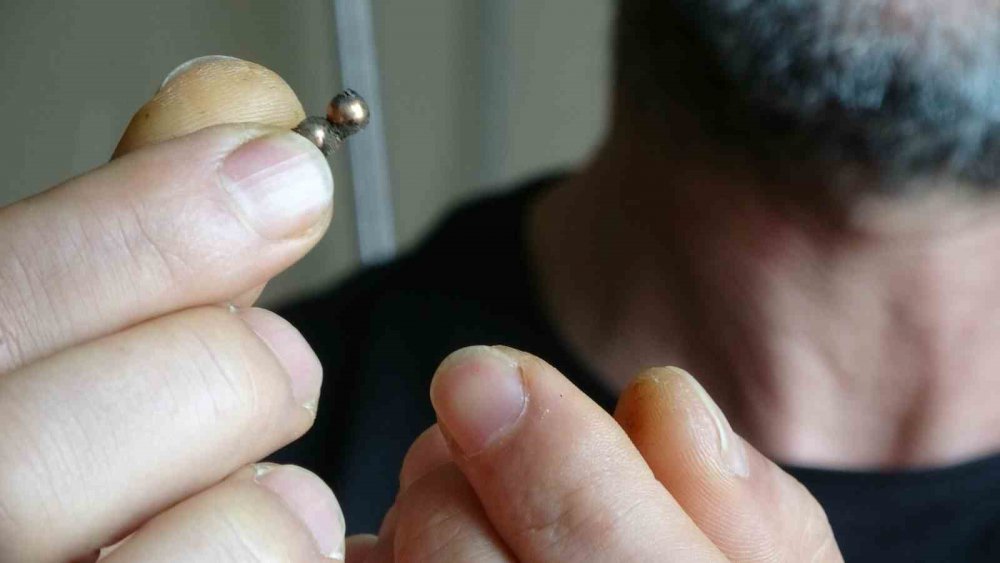 RİZE'DE KARIN AĞIRISI VE KUSMA NEDENİYLE GİTTİĞİ HASTANEDE ERKENDEN TEŞHİS EDİLEREK AMELİYATA ALINAN 7 YAŞINDAKİ MİRAÇ KALAY'IN YUTTUĞU MIKNATISLI DEMİR BİLYELERİN 3 YERDEN BAĞIRSAĞINI DELDİĞİ ORTAYA ÇIKTI