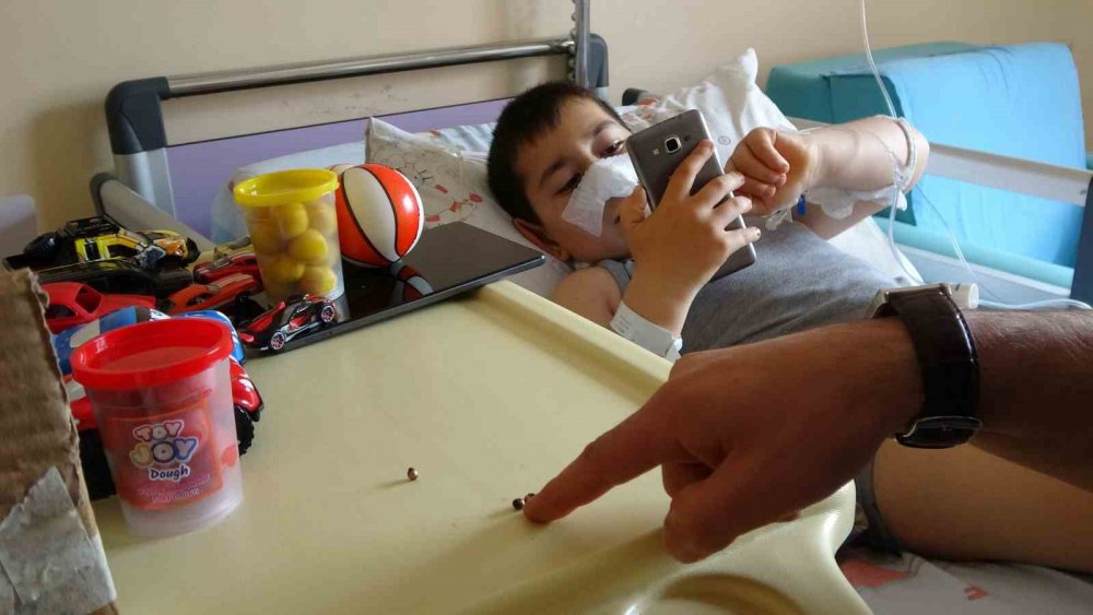 RİZE'DE KARIN AĞIRISI VE KUSMA NEDENİYLE GİTTİĞİ HASTANEDE ERKENDEN TEŞHİS EDİLEREK AMELİYATA ALINAN 7 YAŞINDAKİ MİRAÇ KALAY'IN YUTTUĞU MIKNATISLI DEMİR BİLYELERİN 3 YERDEN BAĞIRSAĞINI DELDİĞİ ORTAYA ÇIKTI