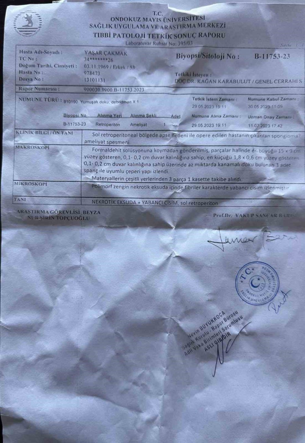 GİRESUN'DA 2005 YILINDA ANJİYO İÇİN GİTTİĞİ HASTANEDE KARNINDA ÜÇ PARÇA GAZLI BEZ UNUTULAN, YILLARDIR UNUTULAN GAZLI BEZDEN HABERSİZ SANCI ÇEKEN VE KANSER TEŞHİSİYLE TEDAVİ GÖREN YAŞAR ÇAKMAK GERÇEĞİ 18 YIL SONRA ÖĞRENDİ