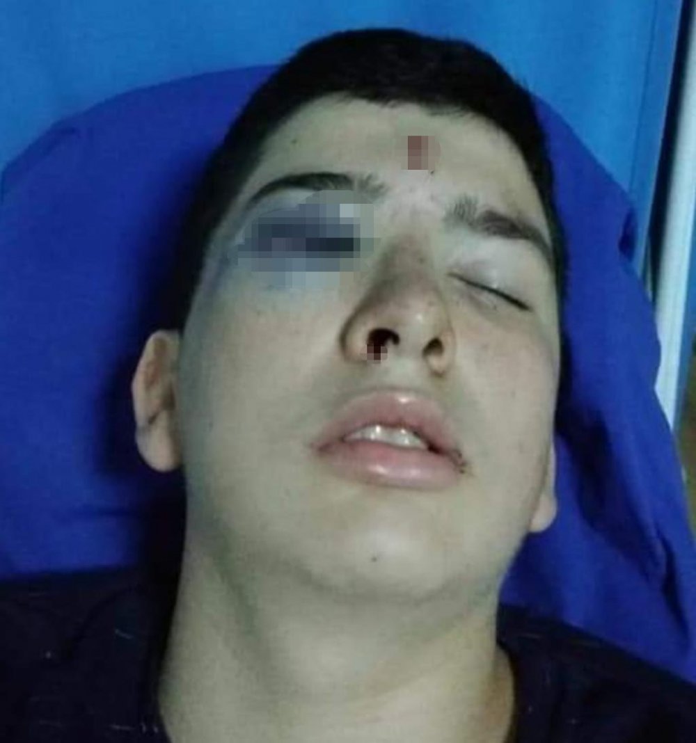 TRABZON’DA 8 YILDA YORGUN MERMİDEN 5 KİŞİ ÖLDÜ, 100’E YAKIN KİŞİ YARALANDI