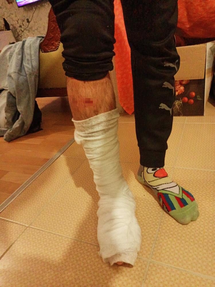 Ordu Fatsa'da Motosiklet Sürücüsü, Çarpıştığı Patpatın Altında Kaldı