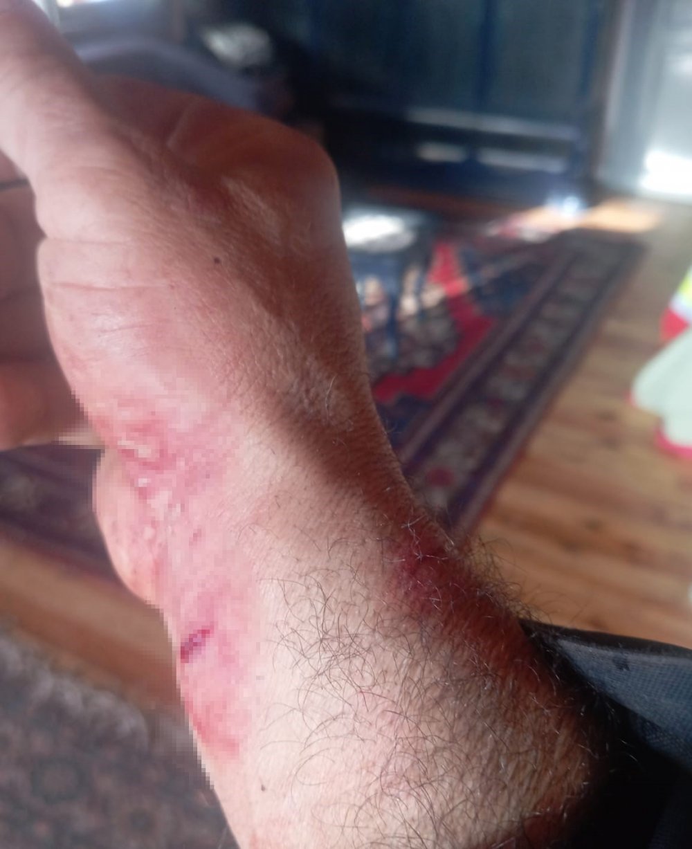 Kurt Saldırısından Köpekleri Sayesinde Kurtuldu