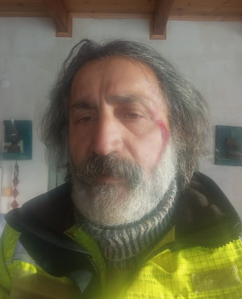 Kurt Saldırısından Köpekleri Sayesinde Kurtuldu