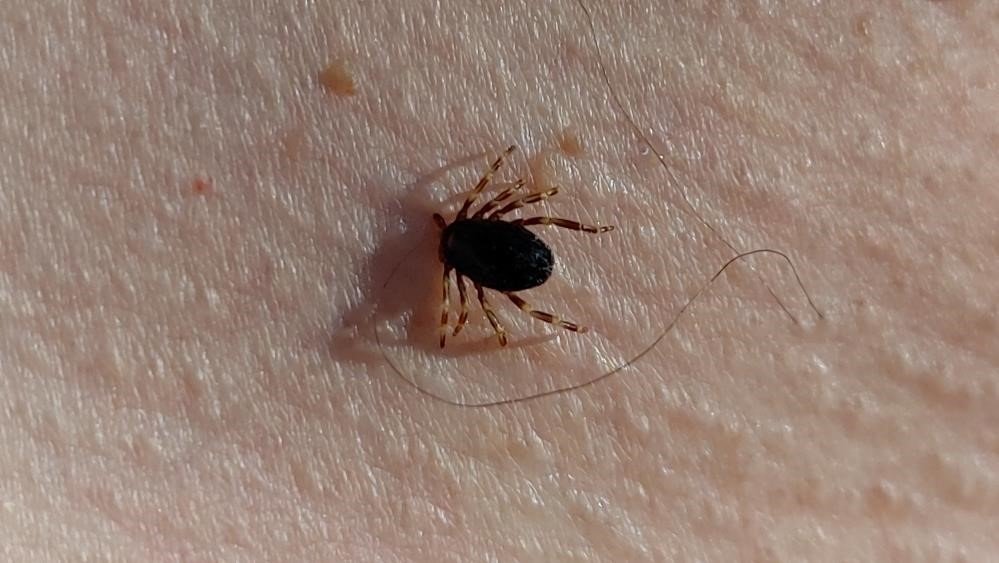 Havalar Isındı, Kene Kabusu Başladı, ilk vaka Trabzon'da