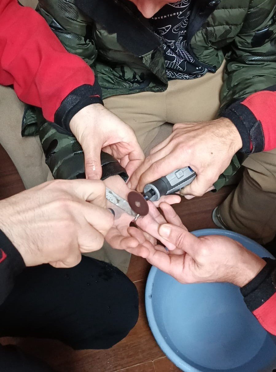 Rize’de 10 yaşındaki çocuğun parmağına sıkışan madeni para itfaiye ekiplerince çıkarıldı