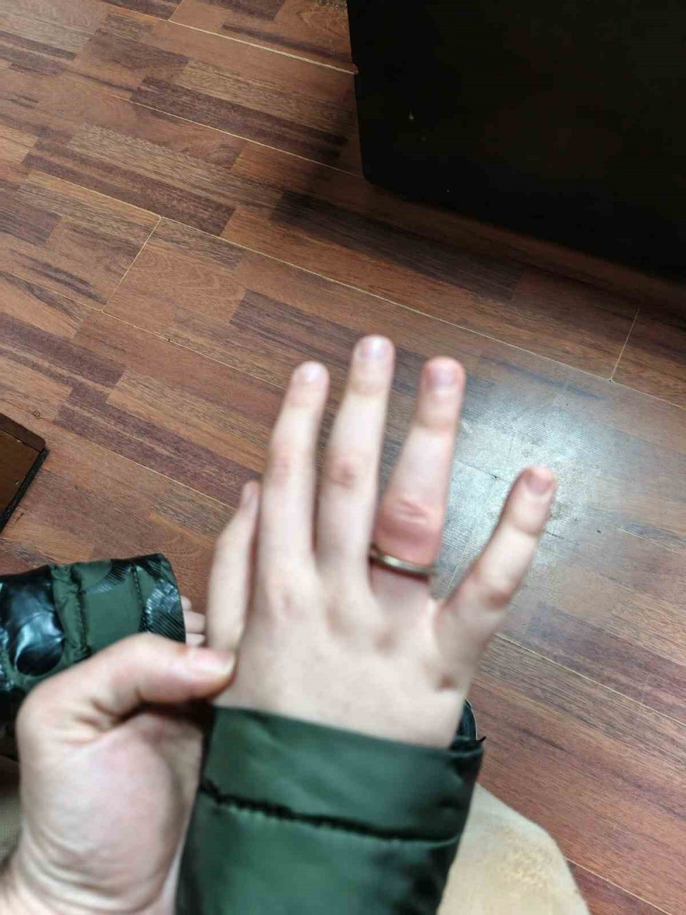 Rize’de 10 yaşındaki çocuğun parmağına sıkışan madeni para itfaiye ekiplerince çıkarıldı