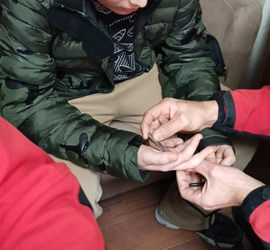 Rize’de 10 yaşındaki çocuğun parmağına sıkışan madeni para itfaiye ekiplerince çıkarıldı